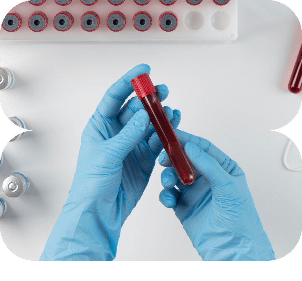 Professional home blood sample collection service in Bangalore